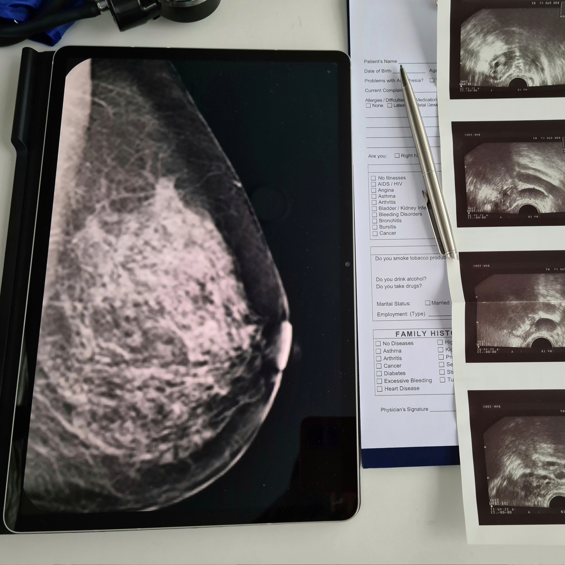 Mammographie in der Radiologie Eggenfelden